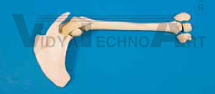 Humerus, fractured, Scapula